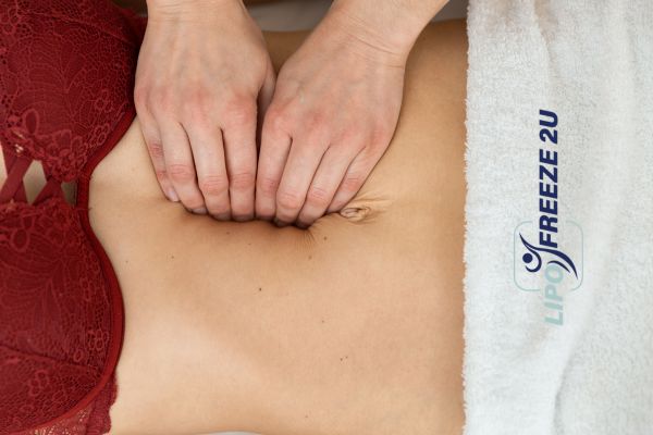 diastasis recti treatment Hertford