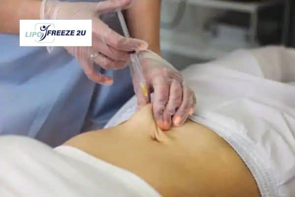 How Does Aqualyx Fat Dissolving Injection Work to Break Down Fat Hertford?