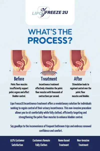Diagram of how incontinence treatment Hertford works.