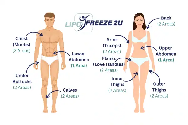 Areas you can have fat freezing treatment Hertford