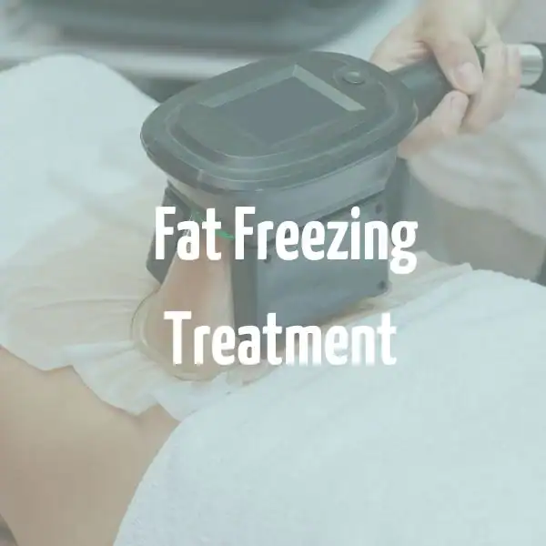 fat freezing treatment Hertford