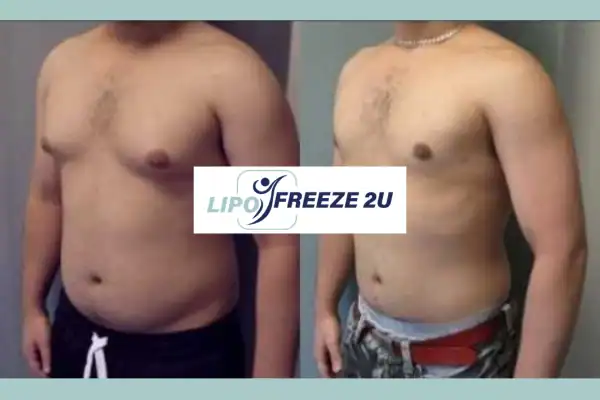 How Long Does It Take to See Results Hertford?