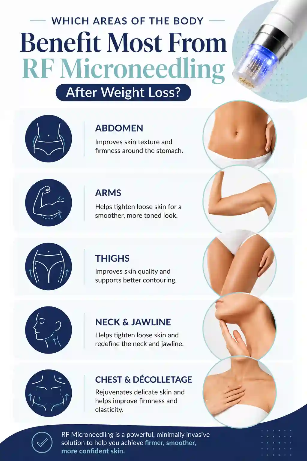 Which Areas of the Body Benefit Most From RF Microneedling After Weight Loss Hertford